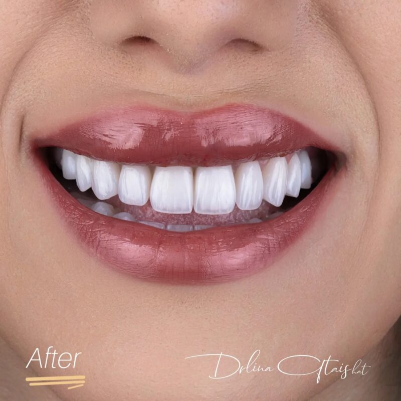 Periodontist vs General Dentist: Which One Should You Choose?